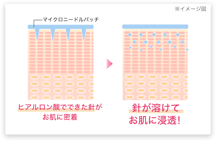 ヒアルロン酸でできた針がお肌に密着→針が溶けてお肌に浸透！のイメージ図